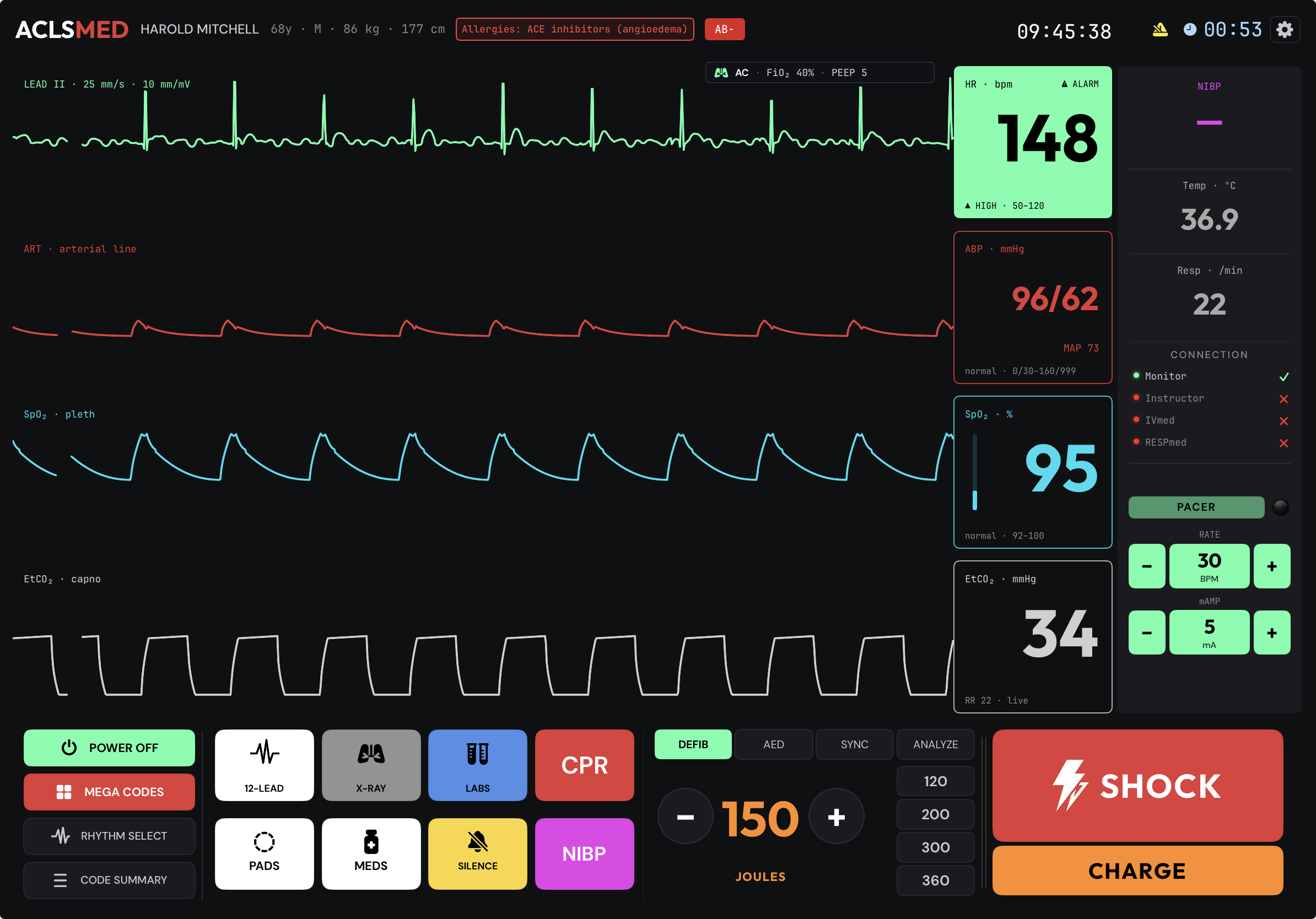 SVT — AVNRT — ACLSmed monitor view with narrow-complex tachycardia, HR 148, BP 96/62