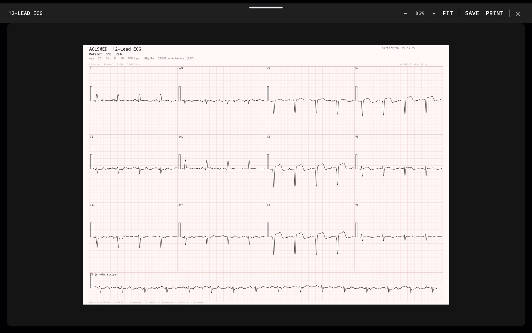 ACLSMED 12-lead ECG print