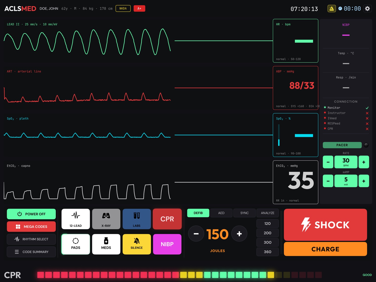 ACLSMED Monitor in asystole with CPR active: compression artifact on the ECG, the CPR tile pulsing and the metronome on
