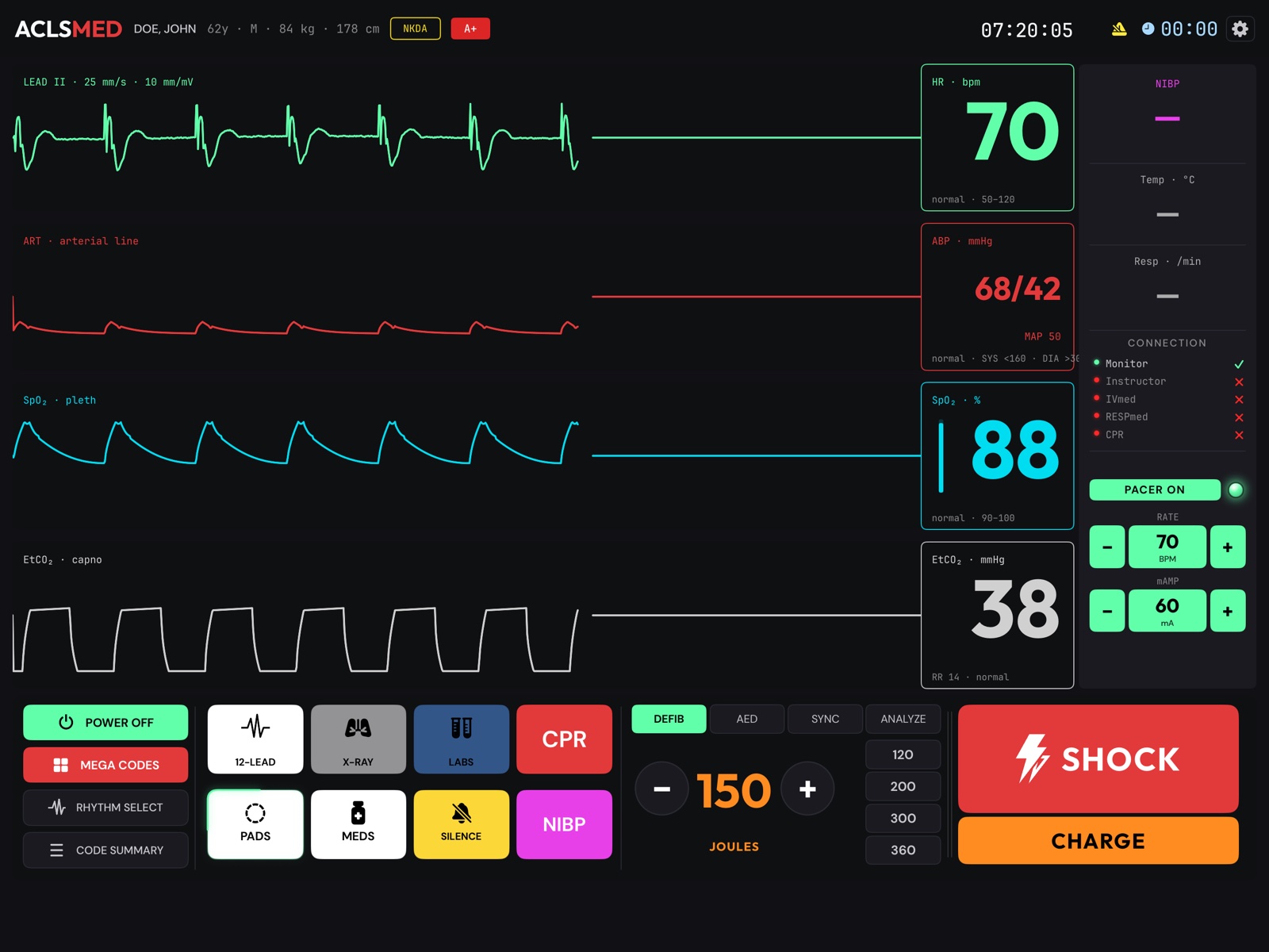 ACLSMED Monitor pacing a complete heart block: pacer spikes with capture on the ECG, PACER ON lit, rate 70 and 60 mA