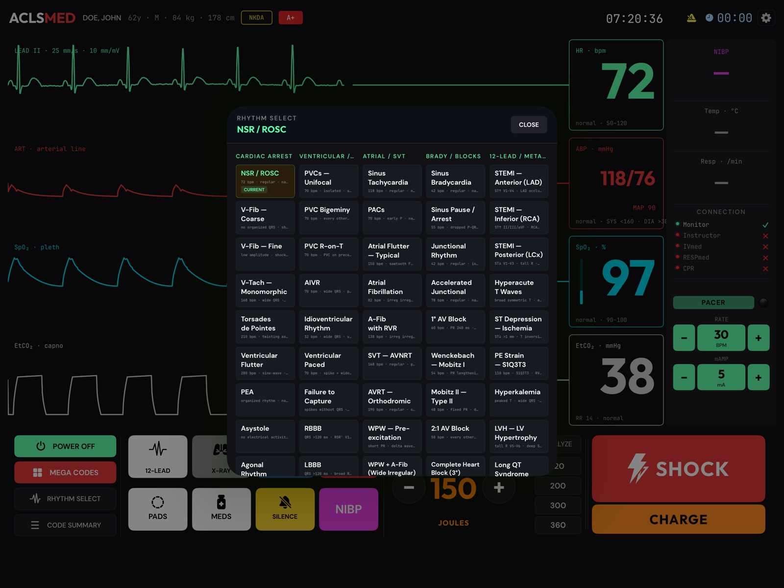 ACLSMED Monitor RHYTHM SELECT catalog with 47 rhythms in five columns