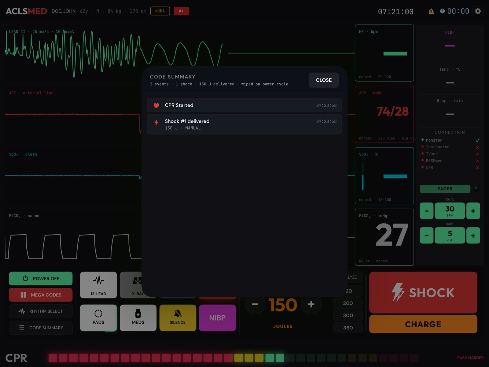 ACLSMED Monitor CODE SUMMARY sheet listing shocks, CPR intervals and drugs with timestamps