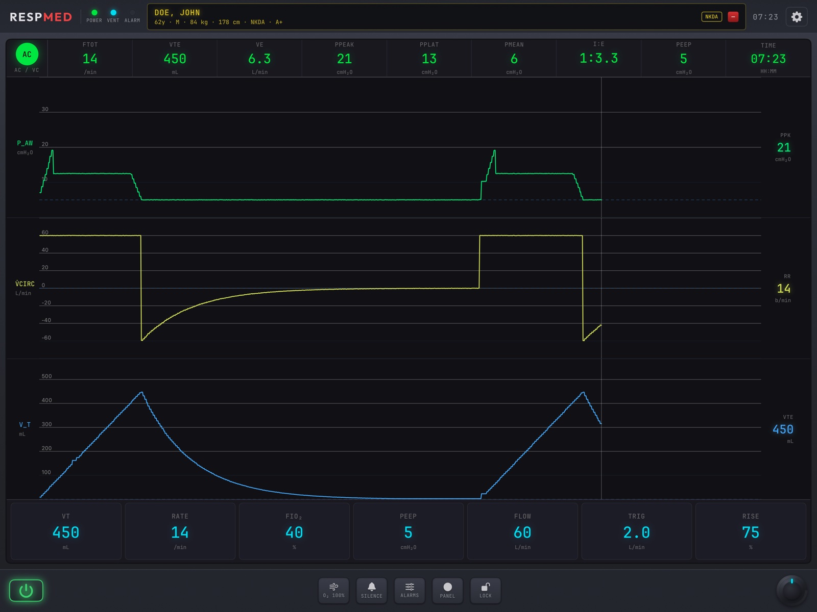 ACLSMED RESPmed ventilator in landscape: status bar with the mode circle, pressure, flow and volume waveforms, the parameter tiles, and the chassis keys