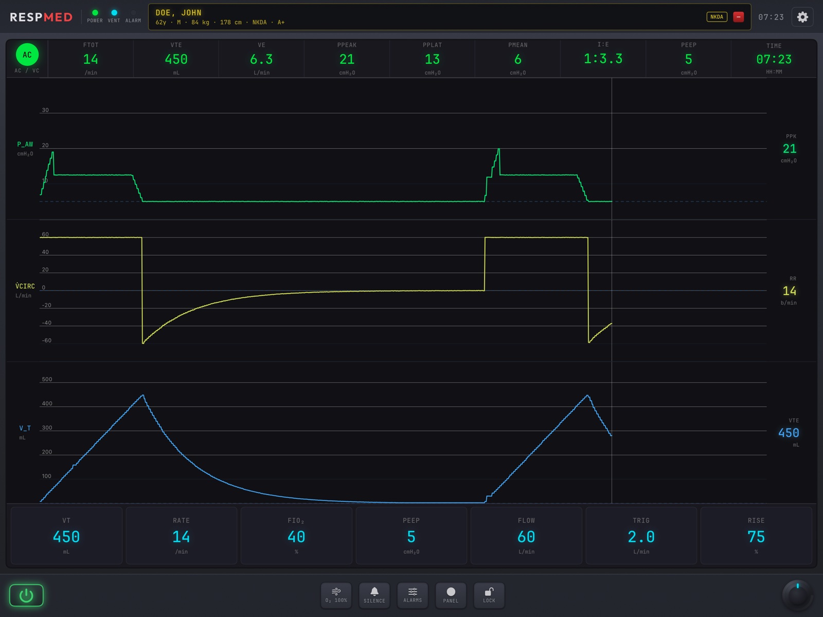 ACLSMED RESPmed parameter editor for tidal volume with minus and plus steppers and exact-value chips